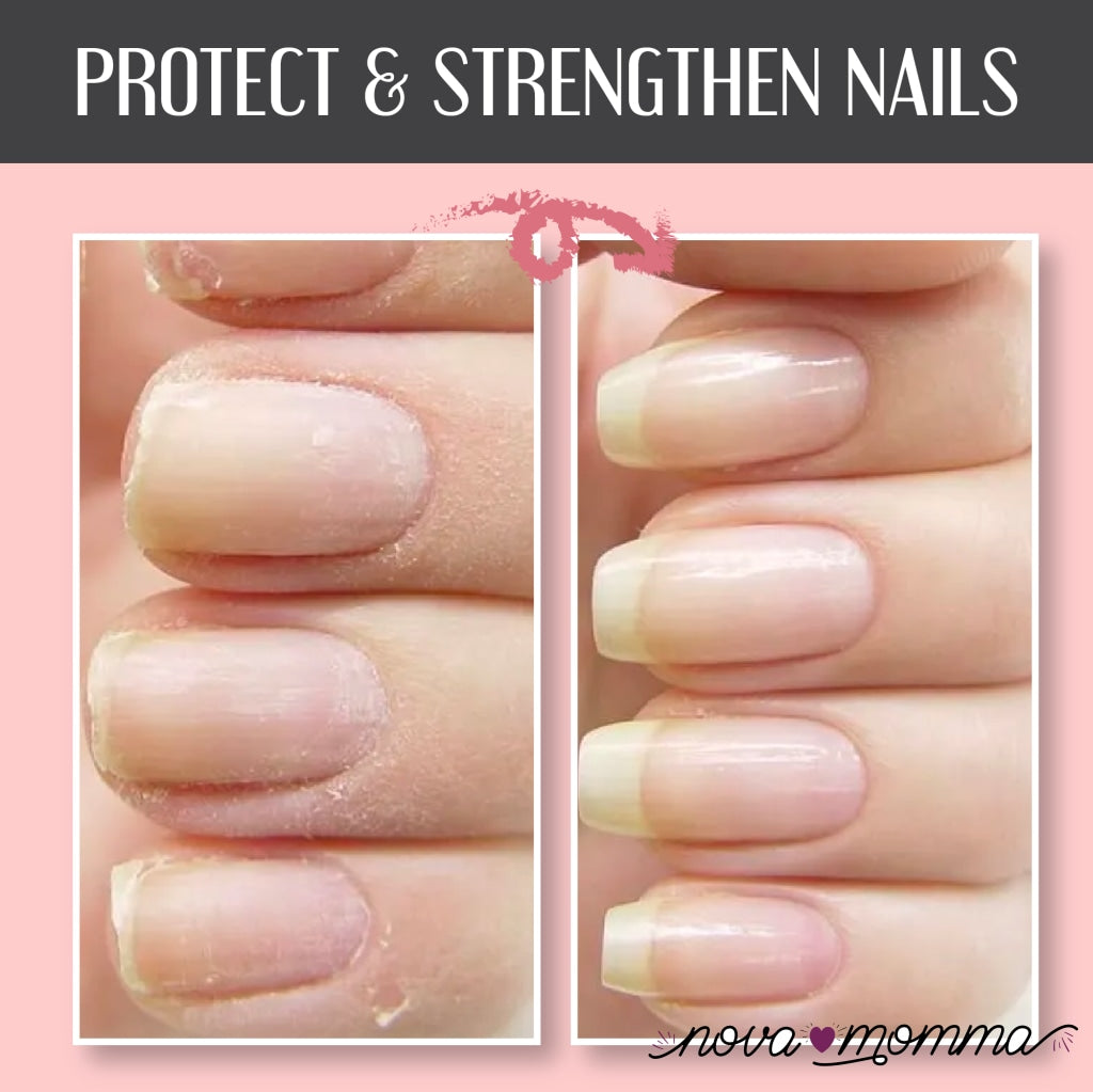 Instant Nail Repair Protect Gel